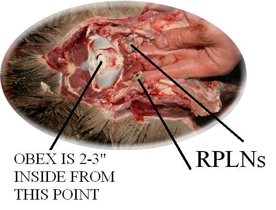 Retropharyngeal Lymph Nodes in Relation to Brainstem